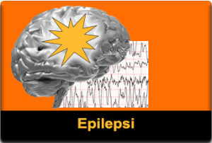 Epilepsi