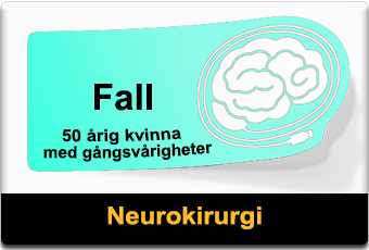 Fall: 50 årig kvinna med gångsvårigheter