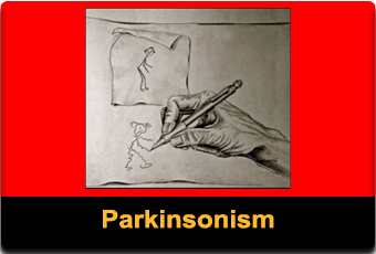Parkinsonism utredning och diagnos